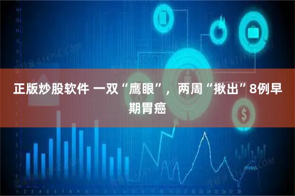 正版炒股软件 一双“鹰眼”，两周“揪出”8例早期胃癌